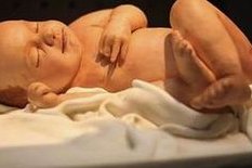 高龄绝经去阿尔法国际助孕中心做三代试管贵吗？需要花费多少钱？