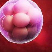 女性患有多囊卵巢综合征怎么做试管婴儿