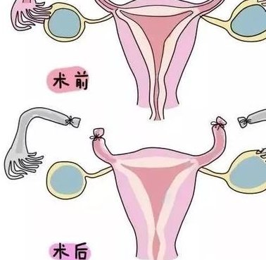 青海知名始基子宫试管医院排名介绍，试管婴儿费用最新说明分析