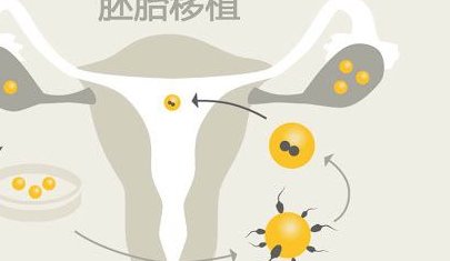 泰国做三代试管婴儿成功率怎么样？